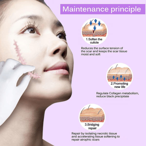 Scar Removal Cream Repair Stretch Marks Burn Acne Surgical Acne Scar Ointment Herbal Treatment Gel
