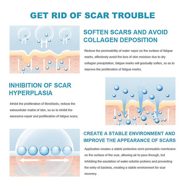 Scar Removal Cream Repair Stretch Marks Burn Acne Surgical Acne Scar Ointment Herbal Treatment Gel
