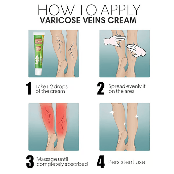 Vein Smoothing Varicoses Veins Cream
