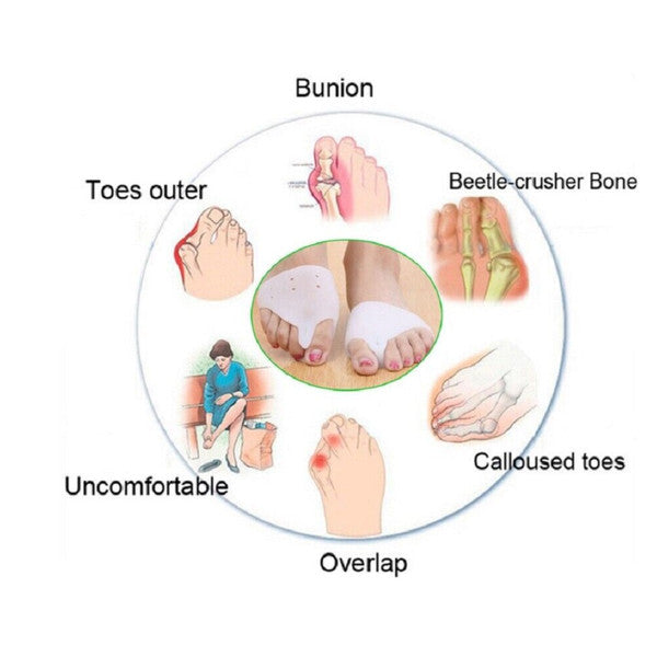 1 Pair Bunion Splint Big Toe Straightener Corrector Hallux Valgus Pain Relief-HTE001