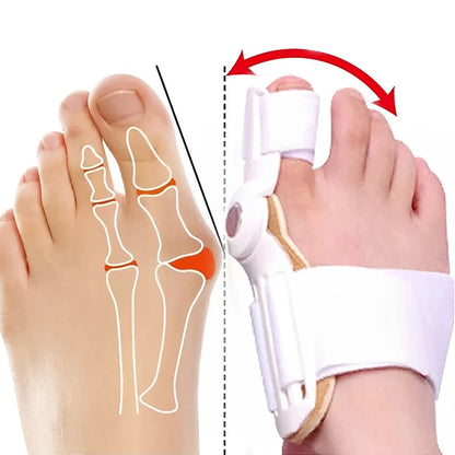 Doctor Recommended Bunion Corrector For Men & Women