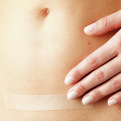 Medical Soft Silicone Gel Tape for Scar Removal – Effective & Safe Scar Treatment