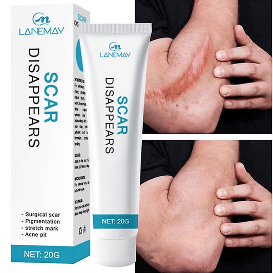 Scar Removal Cream Repair Stretch Marks Burn Acne Surgical Acne Scar Ointment Herbal Treatment Gel